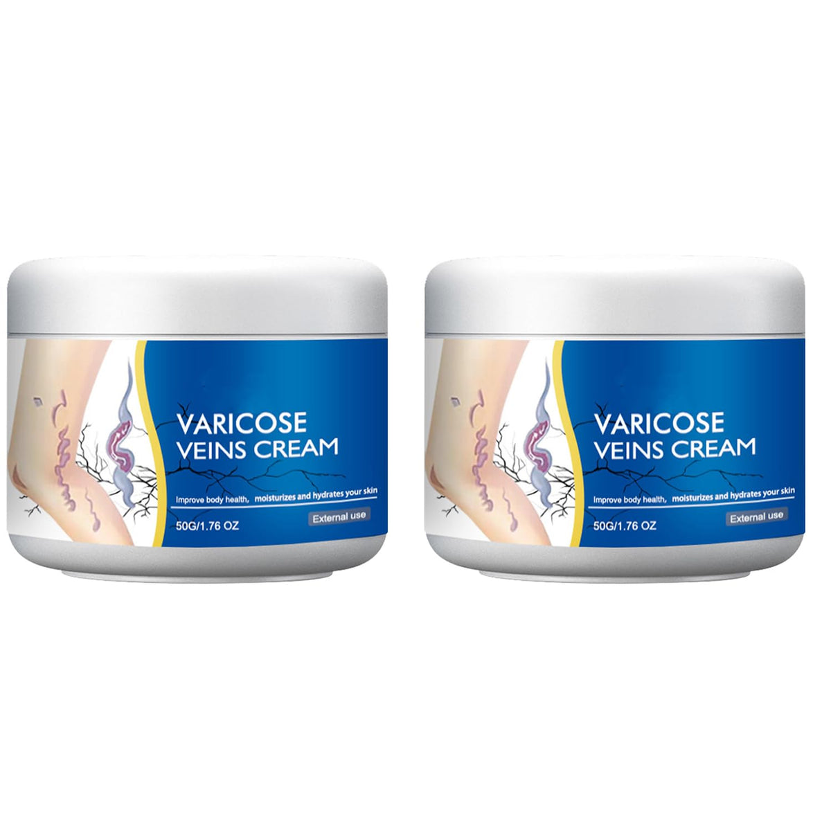 Varicose Veins Treatment Cream for Legs