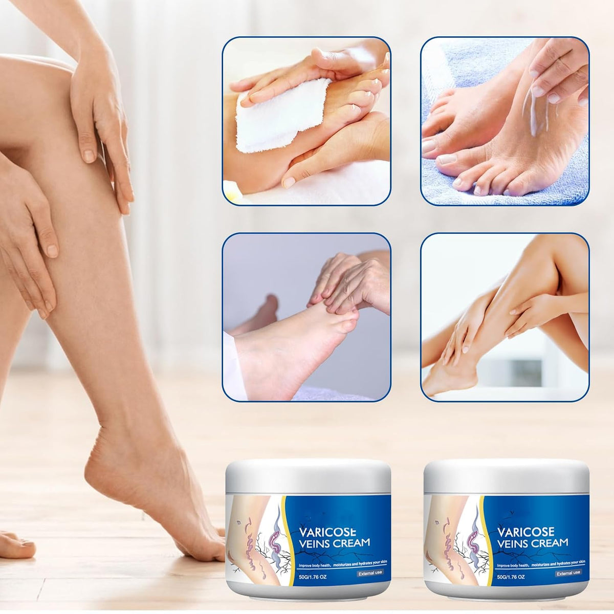 Varicose Veins Treatment Cream for Legs